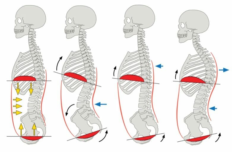 Creating The Foundation With Abdominal Bracing, PDF