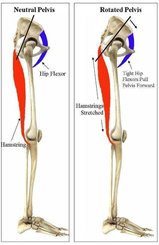 tight hip flexors